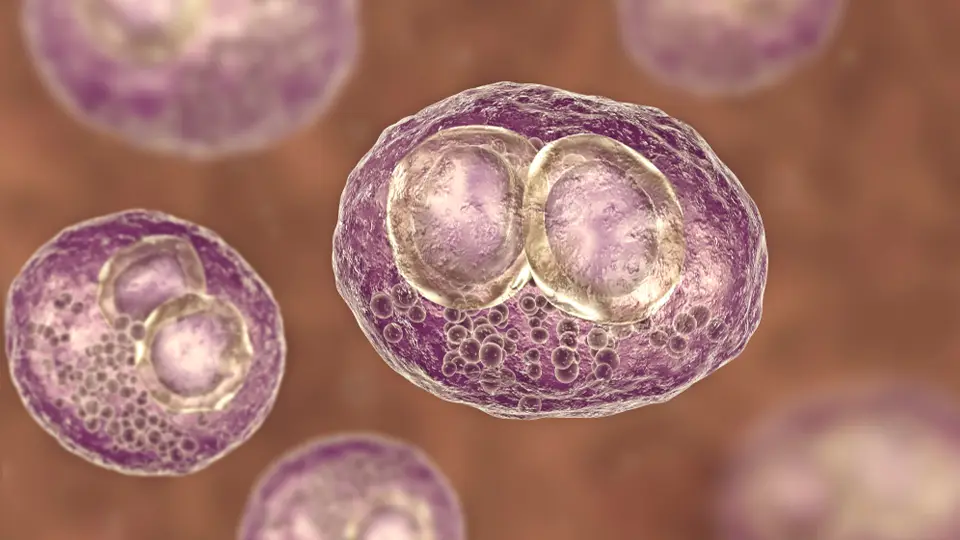 PCR, Herpes Simplex Virus IgM Antibody